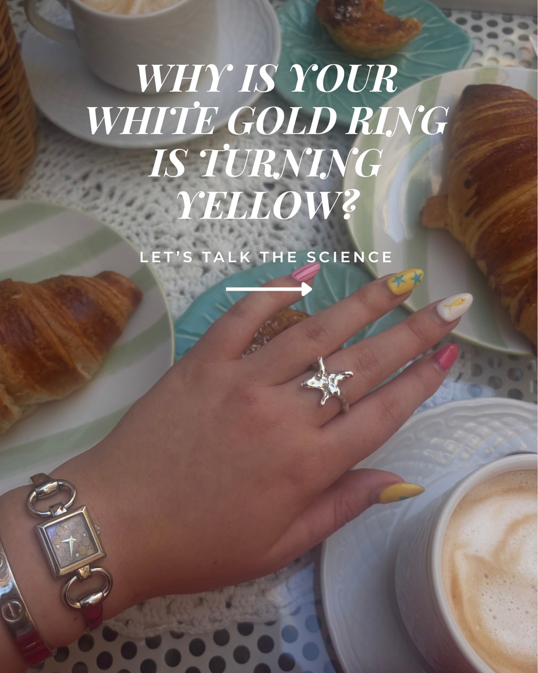 s your white gold ring turning yellow? Don't panic, it's not ruined. 💛
White gold isn't naturally white. It's yellow gold mixed with white metals, then coated in a thin layer of rhodium to give it that bright, mirror-white shine.
Over time, that plating wears away through everyday life: friction, hand creams, perfume, chlorine and cleaning products. As it thins, the warm tone of the gold underneath shows through.
The fix? A quick re-plate. Most rings need one every 1 to 2 years, and afterwards they look brand new. ✨
Top tips to keep it whiter for longer:
🤍 Take it off for swimming, cleaning and the gym
🤍 Apply lotion and perfume before your rings
🤍 Store it separately from other jewellery
📍 Good news: you can get your rhodium plating done at all 7 of our stores! Pop into your nearest branch or message us to book your ring in for a refresh. 💍
#WhiteGold #RhodiumPlating #JewelleryCare #WhiteGoldRing #JewelleryTips #DiamondRing #FineJewellery #RingCare