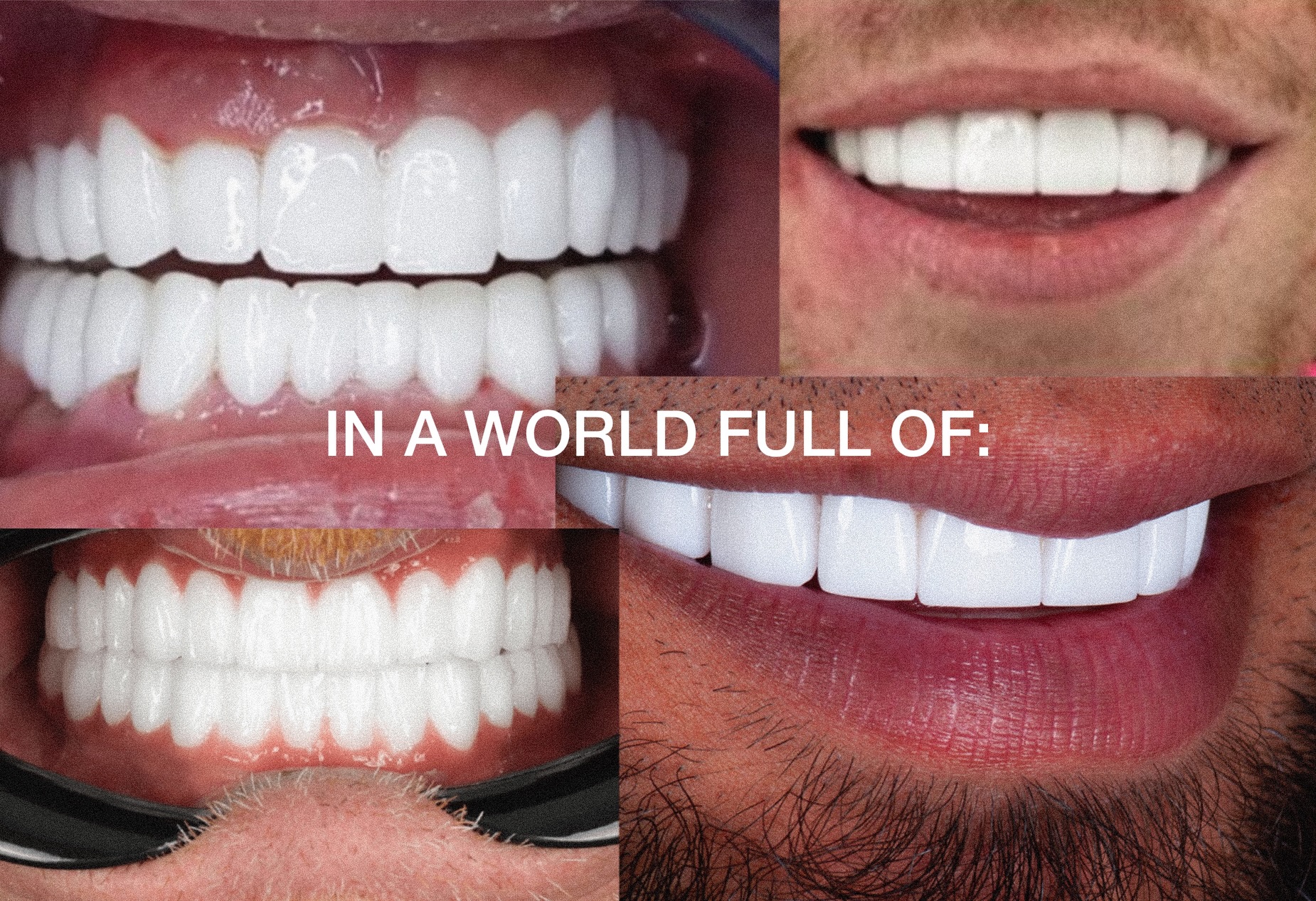 In a world chasing the perfect smile, choose one that looks naturally yours. Healthy. Confident. Beautiful.
#NaturalSmile #SmileConfidence #HealthySmile #Dentistry #edinburghgumsandteeth