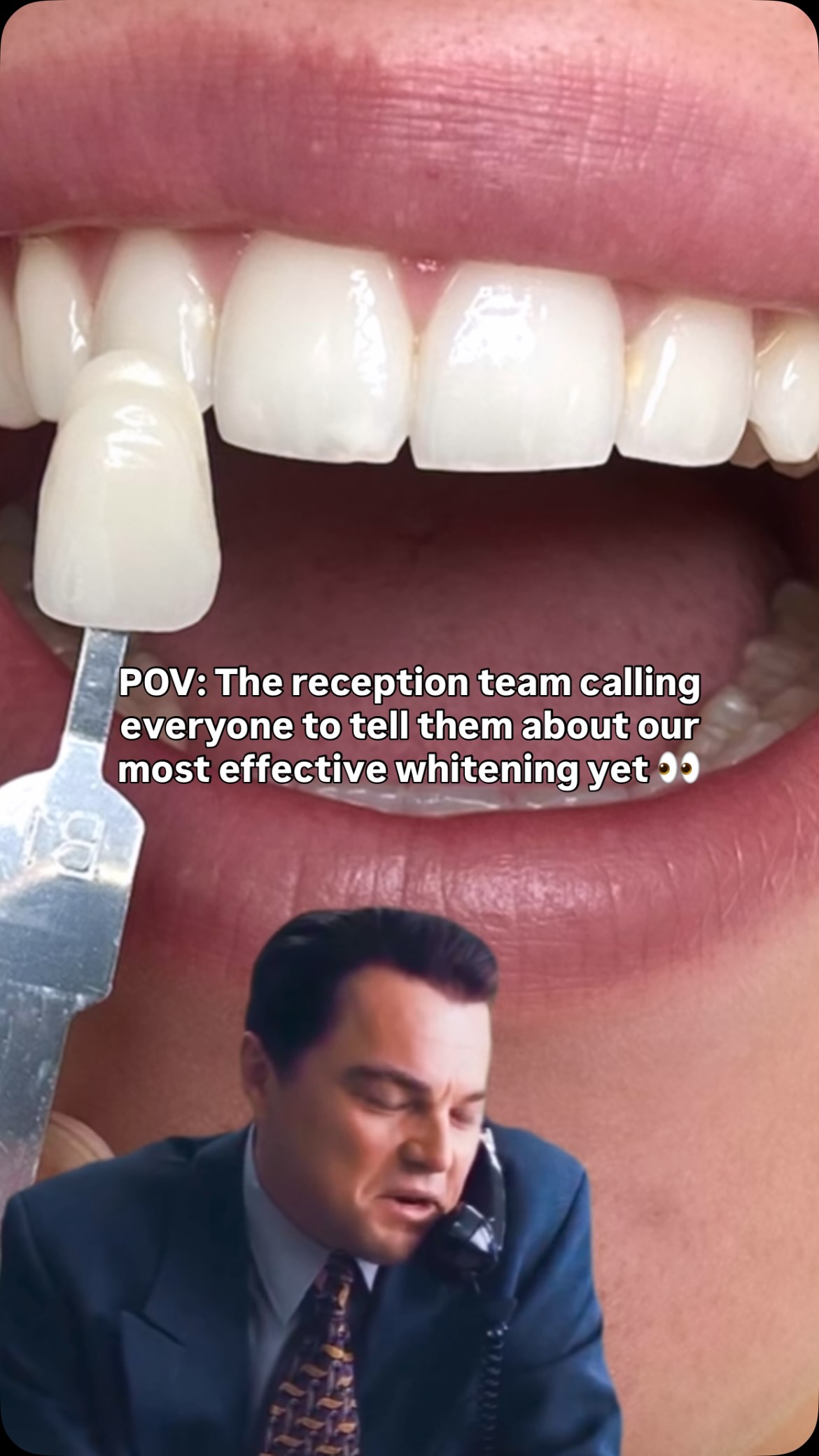 Might sound funny, but it’s true!
We’ve got some seriously effective whitening options at Edinburgh Gums and Teeth 🦷
Comment SMILE to find out which one could be right for you 🤍